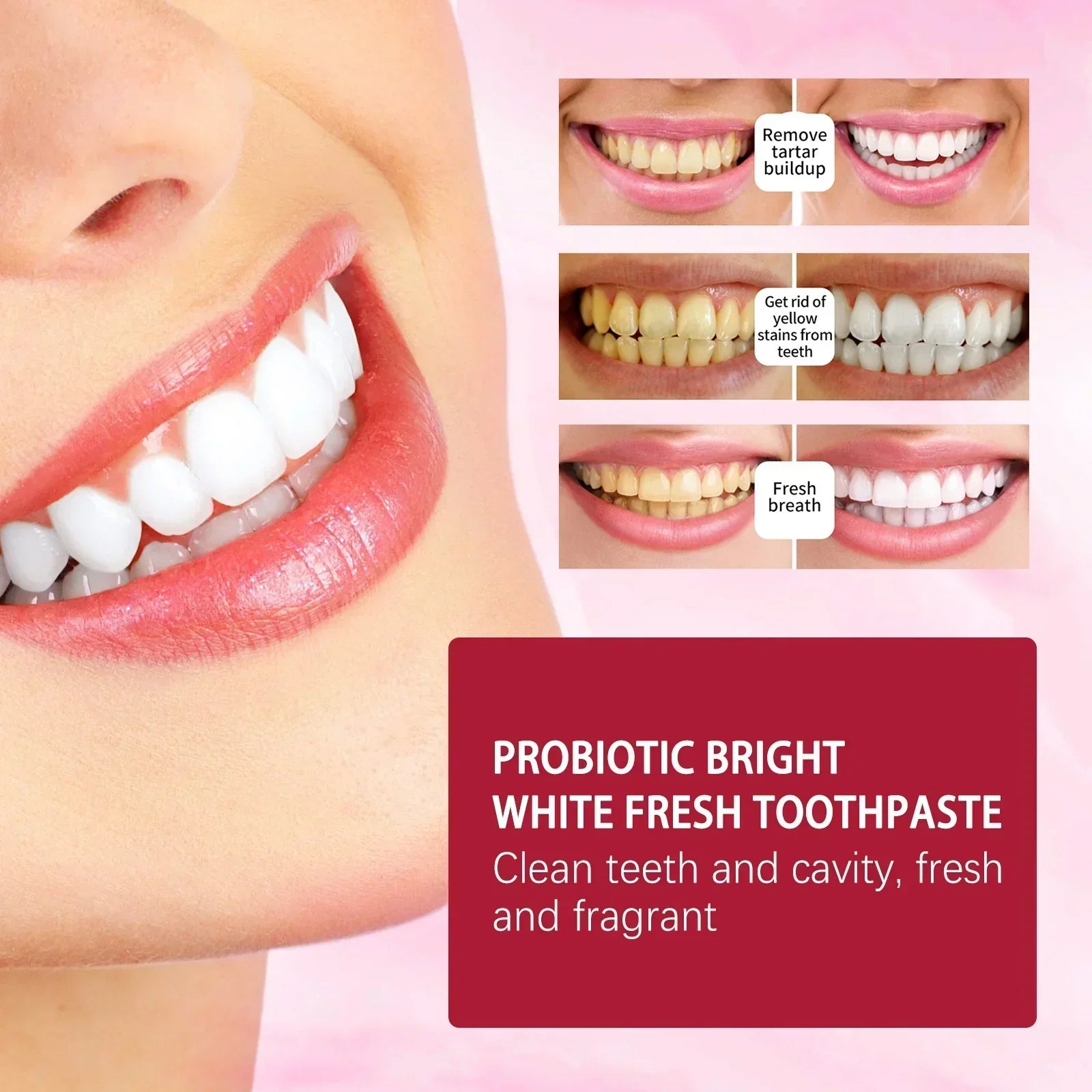 Last Day Of Discount 🔥 SP4 Probiotic Whitening Toothpaste