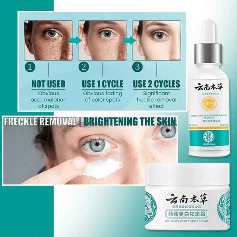 LAST DAY OF DISCOUNT 🔥 ANTI SPOT SERUM